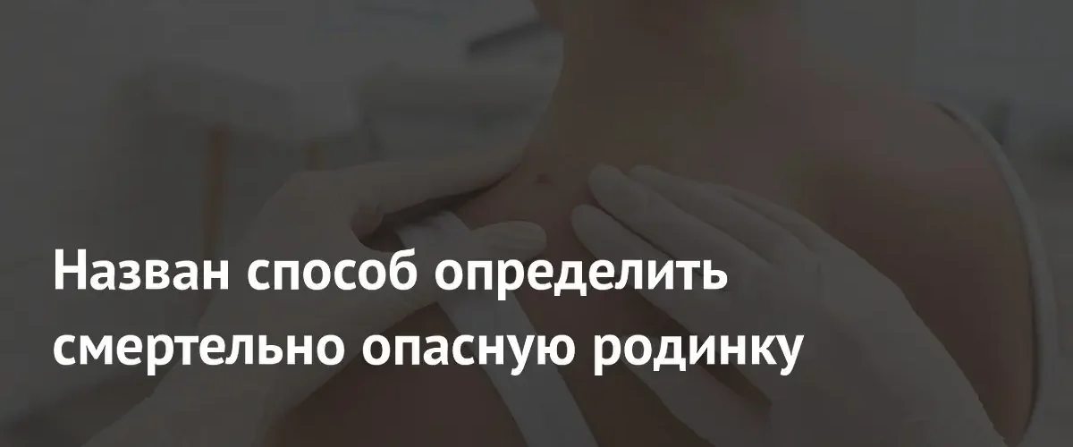 Дерматолог назвала ключевые признаки опасных родинок и правила их проверки
