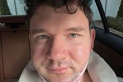 Блогер Стас Васильев рассказал о необычном поведении после хирургической операции