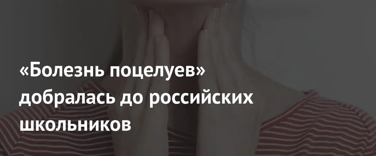 «Болезнь поцелуев» добралась до российских школьников