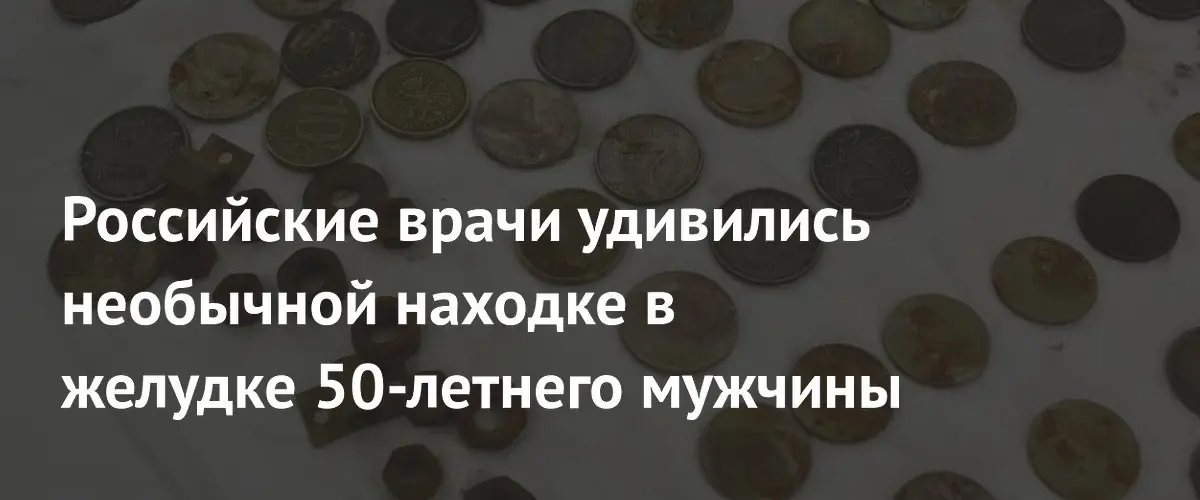 Волгоградские хирурги извлекли из желудка пациента 214 монет и строительные детали