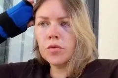 Российская туристка с ребенком подверглась нападению в отеле во Вьетнаме