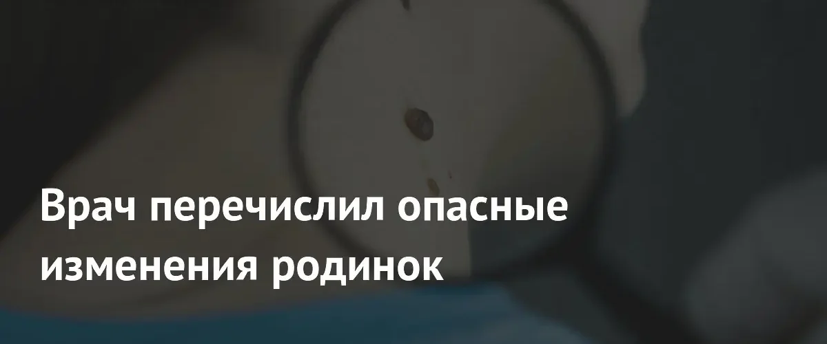 Врач предупредил о признаках меланомы и научил правилу самопроверки кожи