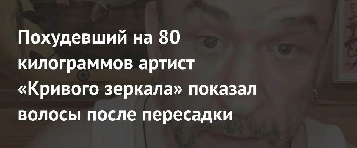 Артист Александр Морозов продемонстрировал результаты пересадки волос после экстремального похудения