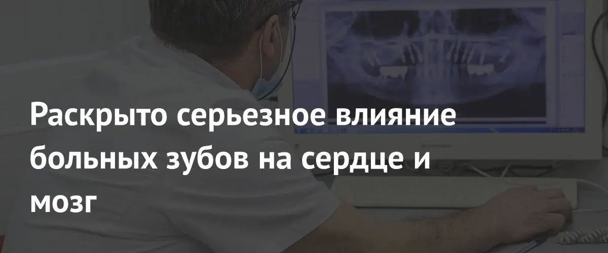 Стоматолог предупредил: больные зубы угрожают сердцу и мозгу